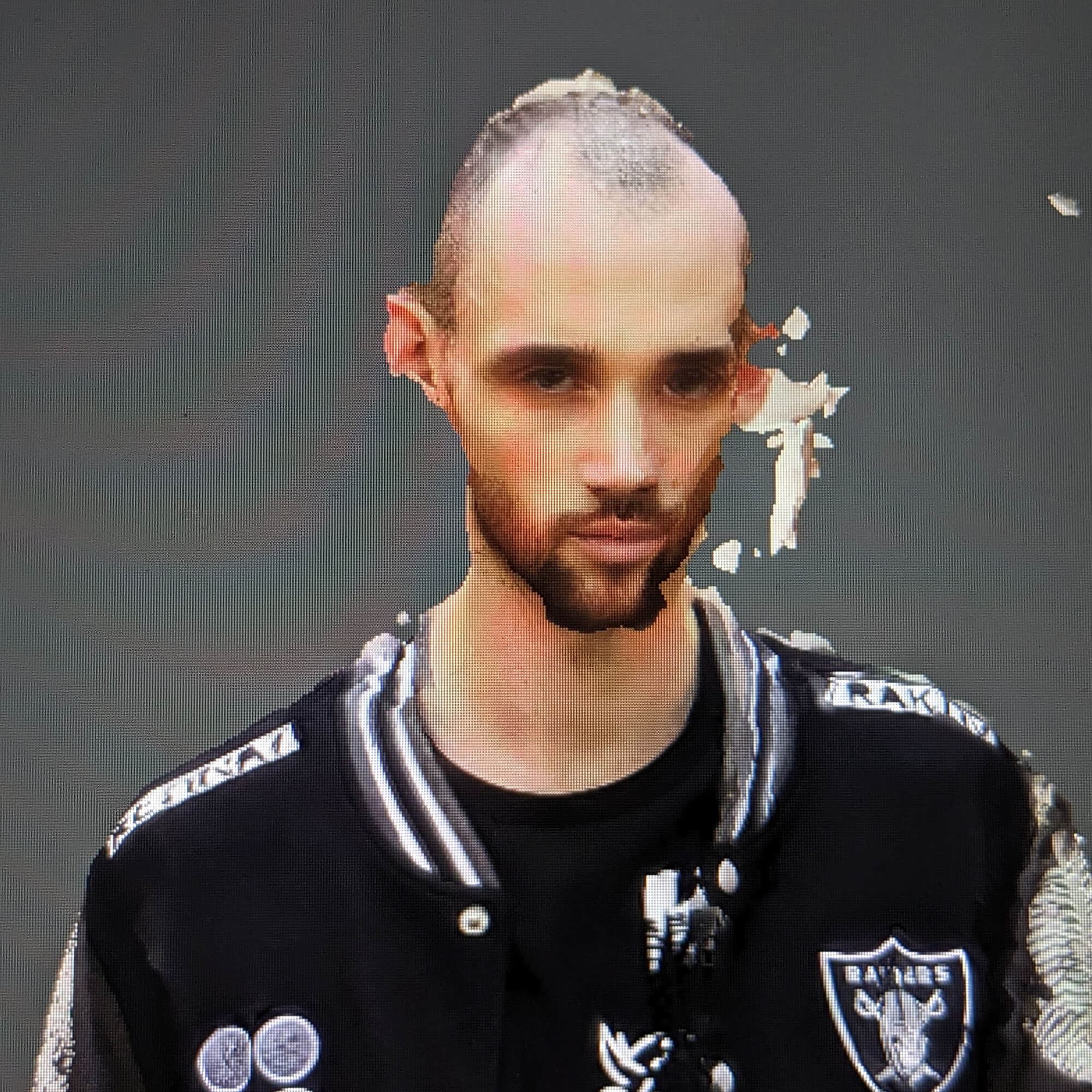 Retinattraktiv